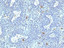 HPV16 Antibody (HPV16/1295) - Azide and BSA Free, Novus Biologicals 100